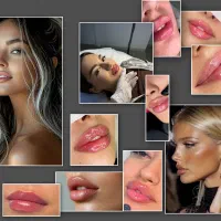 مطب زیبایی و تزریق تخصصی ژل.بوتاکس و بلفاروپلاستی