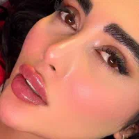 خدمات ژل بوتاکس فیلر|خدمات زیبایی و سلامت|اصفهان, سیچان|دیوار