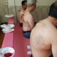 حجامت