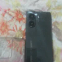 گوشی پوکو x7pro
