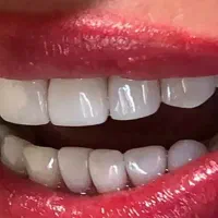 انجام کلیه خدمات دندانپزشکی|خدمات آرایشگری و زیبایی|مشهد, آبکوه|دیوار