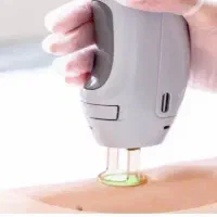 لیزر موهای زاید فیبرنوری