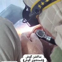 ساکشن گوش-شستشوی گوش|خدمات آرایشگری و زیبایی|دهدشت, |دیوار