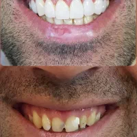 خدمات دندانپزشکی