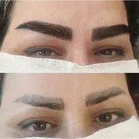 کاشت ابرو تخصصی
