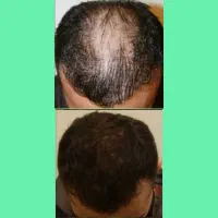 تقویت‌کننده پرطرفدار آقایان
