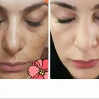 کرم اماراتی عصل مروه گلی|آرایشی، بهداشتی، درمانی|میبد, |دیوار