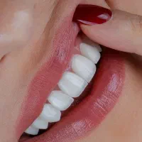 عصب کشی ، پر کردن ، کامپوزیت و زیبایی اقسا*طی