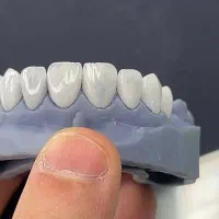 تخفیف ویژه ویژه ویژه روکش|خدمات آرایشگری و زیبایی|تهران, جوادیه|دیوار