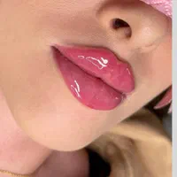 غبغب بوکال لیفت شقیقه سانترال چربی ژل بوتاکس|خدمات آرایشگری و زیبایی|شیراز, قدوسی غربی|دیوار