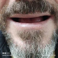 ساخت تخصصی دندان مصنوعی(دندانسازی) (اقساط 6 ماه)|خدمات آرایشگری و زیبایی|قم, شاه ابراهیم|دیوار