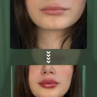 خدمات زیبایی