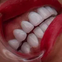 بالاترین کیفیت وارزانترین قیمت خدمات دندانپزشکی|خدمات آرایشگری و زیبایی|شیراز, سینما سعدی|دیوار