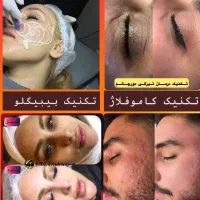 آموزش پوست شیشه ای( مجازی) محو پیسی