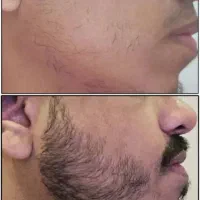 معجزه  اتفاق افتاد