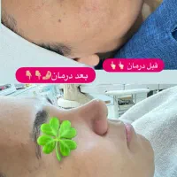 فشیال و اسکراب اسکالپ بطور تخصصی|خدمات آرایشگری و زیبایی|سبزوار, کاشفی شمالی (دادگستری)|دیوار