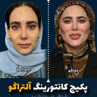 جشنواره کانتورینگ Pro Face بدون جراحی و بیهوشی|خدمات آرایشگری و زیبایی|مشهد, هفت تیر (حافظ)|دیوار