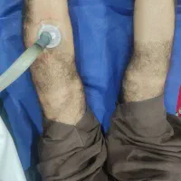 سم زدایی با دستگاه هوشمند ( یون تراپی) حجامت زالو|خدمات آرایشگری و زیبایی|زاهدان, |دیوار