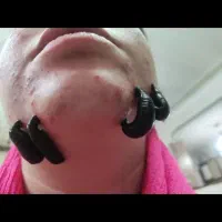 زالو درمانی و فروش زالو