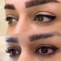 میکروپیگمنتیشن و میکروبلیدینگ