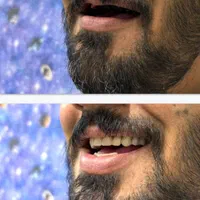 دندانسازی اقساطی