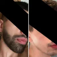 رشد ریش / سبیل / مو / ابرو با پکیج خونگی ضمانتی