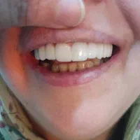 خدمات تخصصی دندانپزشکی تضمینی و اقساطی|خدمات آرایشگری و زیبایی|نیشابور, دارایی|دیوار