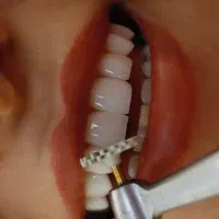 خدمات تخصصی و عمومی دندانپزشکی