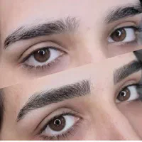 میکرو ریموو،کراتین و احیا،فردائم،اسکراپ اسکالپ|خدمات آرایشگری و زیبایی|پرند, فاز ۲|دیوار