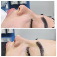 عمل بینی  فقط با پرداخت ۵۴ تومن