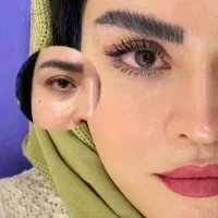 جشنواره تکرار نشدنی ساکشن غبغب و ..کلینیک پالادیوم|خدمات آرایشگری و زیبایی|شیراز, معالیآباد|دیوار