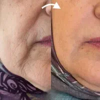 کرم بیوممتیک تخصصی پنج کاره گاتیو