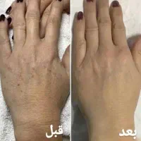 تخفیفات ویژه پی آر اف(PRF) پی ار پی|خدمات زیبایی و سلامت|شیراز, چوگیاه|دیوار
