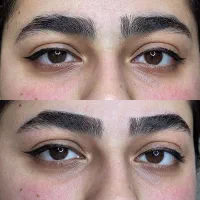 مرکز تخصصی اصلاح ابرو