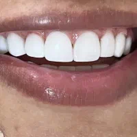 همیشه راهی برای داشتن لبخندی زیبا وجود دارد