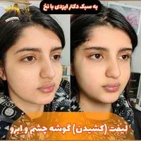 چربی بیکینی لابیا پلاستی تنگی انواع جراحی لیفت|خدمات آرایشگری و زیبایی|شیراز, شهرک گلستان|دیوار