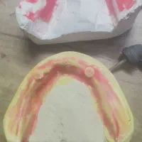 تعدادی قالب دندانسازی گمشده