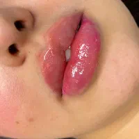 خدمات ژل عربی خلیجی زیبادرکلینیک