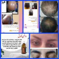 اموزش روغن تراپی همراه با درامد فقط انلاین|خدمات آموزشی|اراک, |دیوار