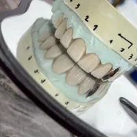 لابرالتوار تخصصی دیجیتال پروتز های دندانی ایلیا