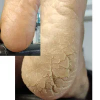 پدیکور و کفسابی پا