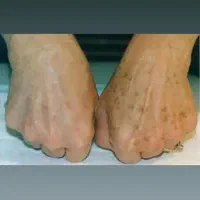 خال|خدمات آرایشگری و زیبایی|سرپل ذهاب, |دیوار