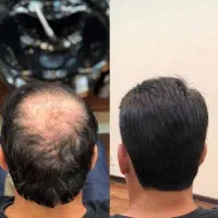 بزار همه از تغییرات بپرسن