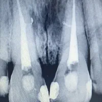 درمان ریشه توسط متخصص در اهواز کیانپارس میهن شرقی