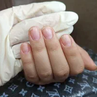 ناخنکده