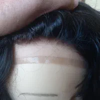 پروتز مو و ترمیم موی شقایق. چسب پروتز|خدمات آرایشگری و زیبایی|تبریز, |دیوار