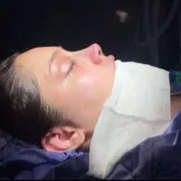 جشنواره جراحی و عمل بینی/پیکرتراشی/لیفت