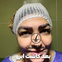 مدل کاشت ابرو|خدمات آرایشگری و زیبایی|گرگان, |دیوار