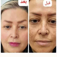 پاکسازی صورت با بهترین برندهای تخصصی