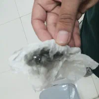 دستگاه بخور گرم و سرد پاکسازی پوست و صورت
